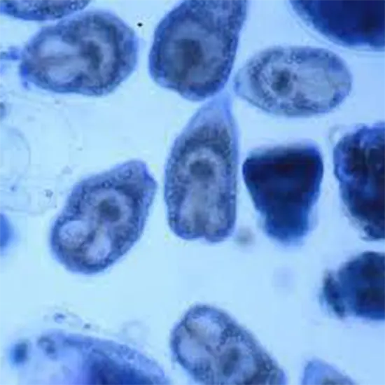 Tiny Tapeworm, Massive Impact : Meet Echinococcus
